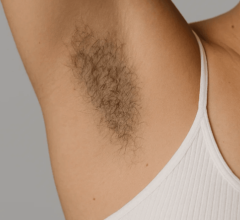 Before facial treatment - client skin condition