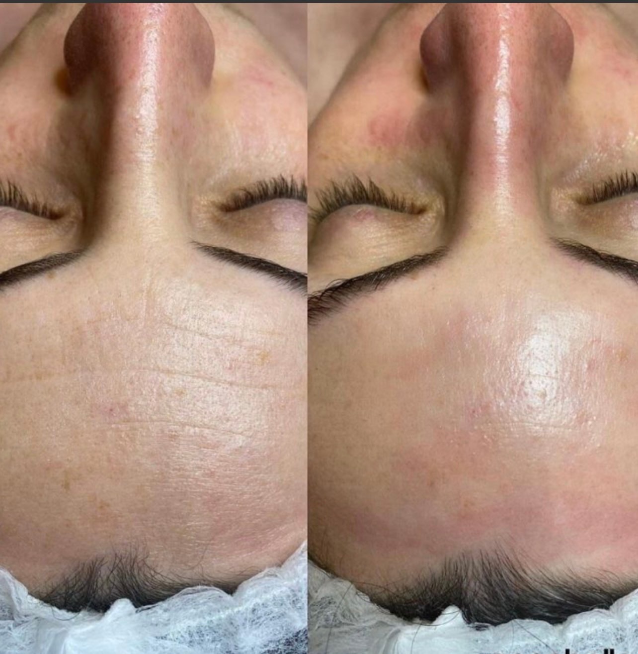 Beauty salon treatment procedure